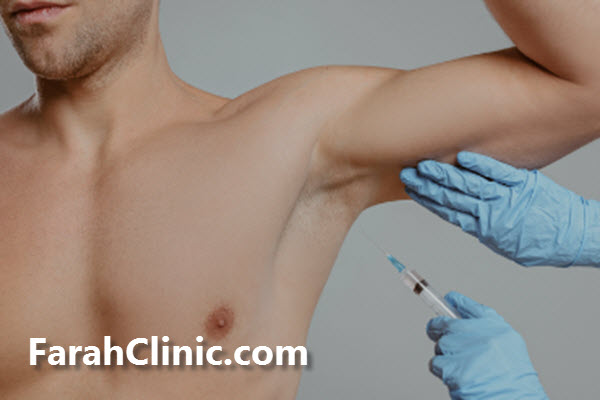 بوتاکس زیر بغل چیست؟