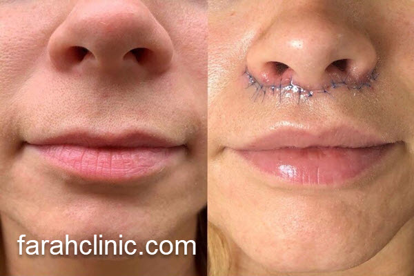 آشنایی با هزینه سانترال لب در 1404 | فرح کلینیک 