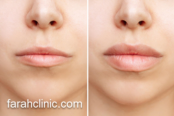 سانترال لب با قیمت مناسب | فرح کلینیک