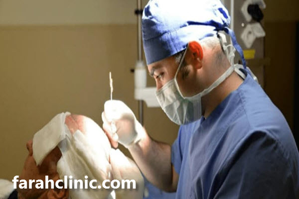 بهترین دکتر آموزش کاشت مو در غرب تهران