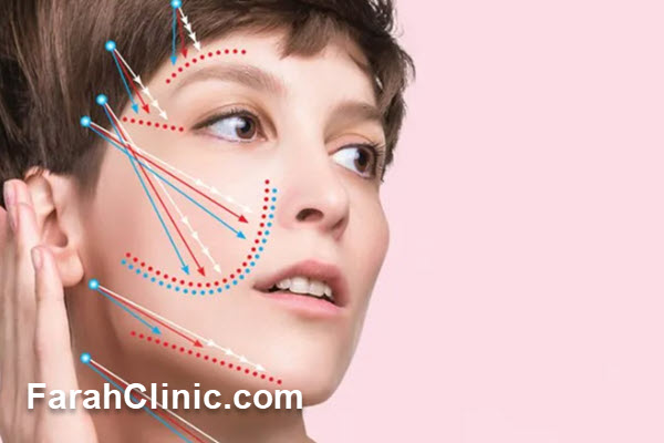 آمادگی های لازم برای انجام لیفت با نخ