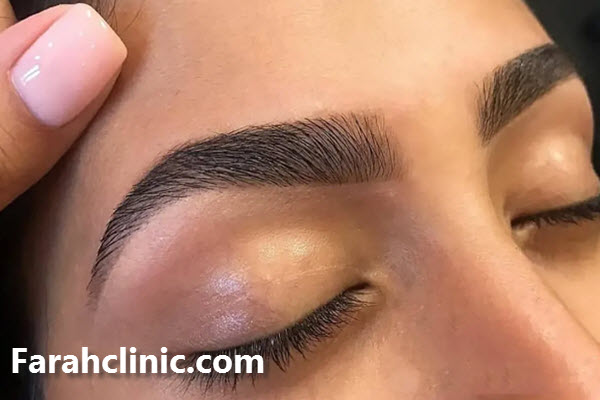 مراقبت های بعد از کاشت ابرو