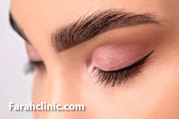 بهترین کلینیک کاشت ابرو در تهران