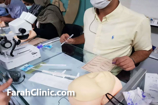 آشنایی با مراحل کاشت مو | غرب تهران