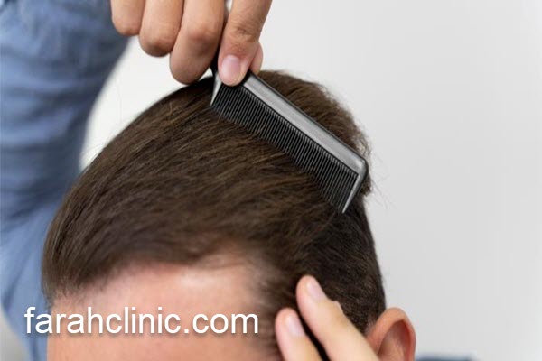 معرفی بهترین روش های کاشت مو | فرح کلینیک