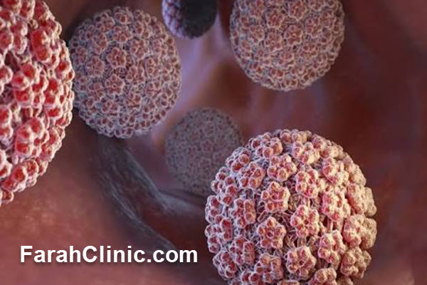 اهمیت تشخیص و درمان تخصصی بیماری HPV