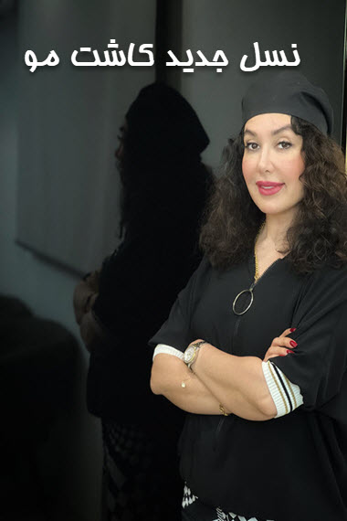 جدیدترین-روش-کاشت-مو-در-تهران جدیدترین روش کاشت مو در غرب تهران | فرح کلینیک