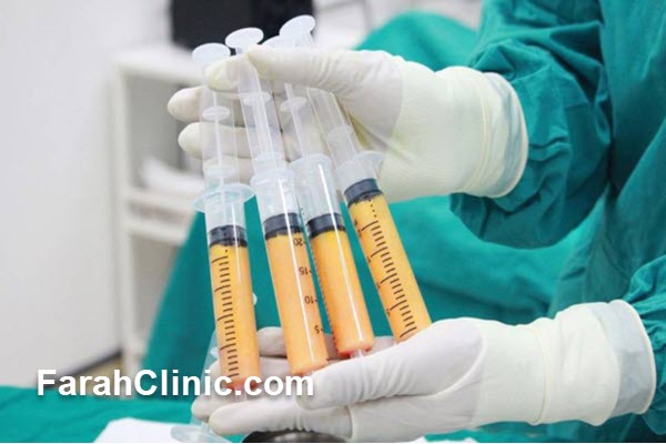 ایمنی تزریق فیلر بادی