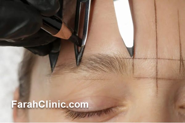 چرا کاشت ابرو در سال ۱۴۰۴ متفاوت است؟