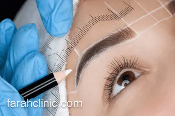 کاشت ابرو بدون جراحی با روش میکروگرافت | فرح کلینیک 