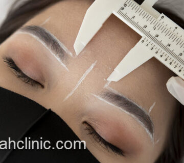 کاشت ابرو با روش میکرو بدون درد | فرح کلینیک