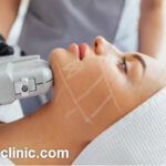 مرکز تخصصی هایفو با نتایج تضمینی