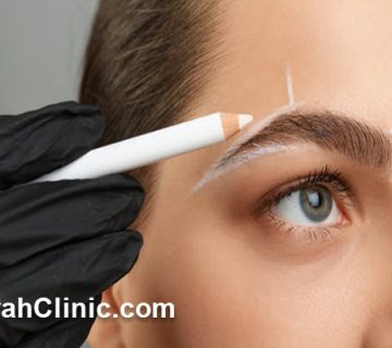بهترین مرکز کاشت ابرو در میرداماد