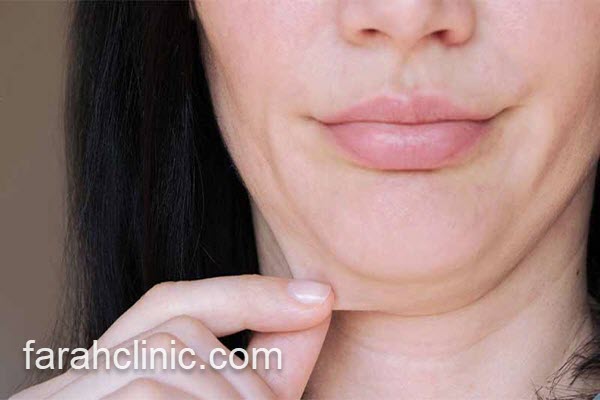 بهترین مرکز ساکشن غبغب در سعادت آباد | فرح کلینیک 