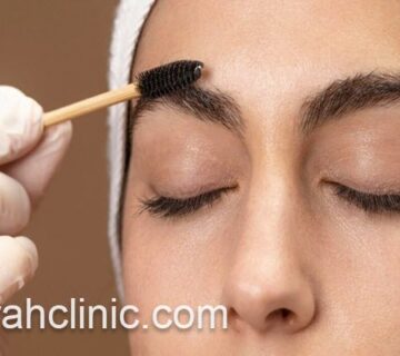 کاشت ابرو با روش جدید | فرح کلینیک
