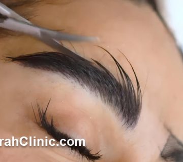 آشنایی با نسل جدید کاشت ابرو در میرداماد