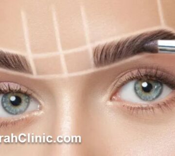 نسل جدید کاشت ابرو در سعادت آباد