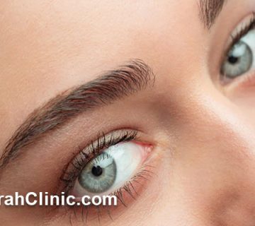 مرکز کاشت ابرو طبیعی در میرداماد